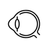 Keratoconus