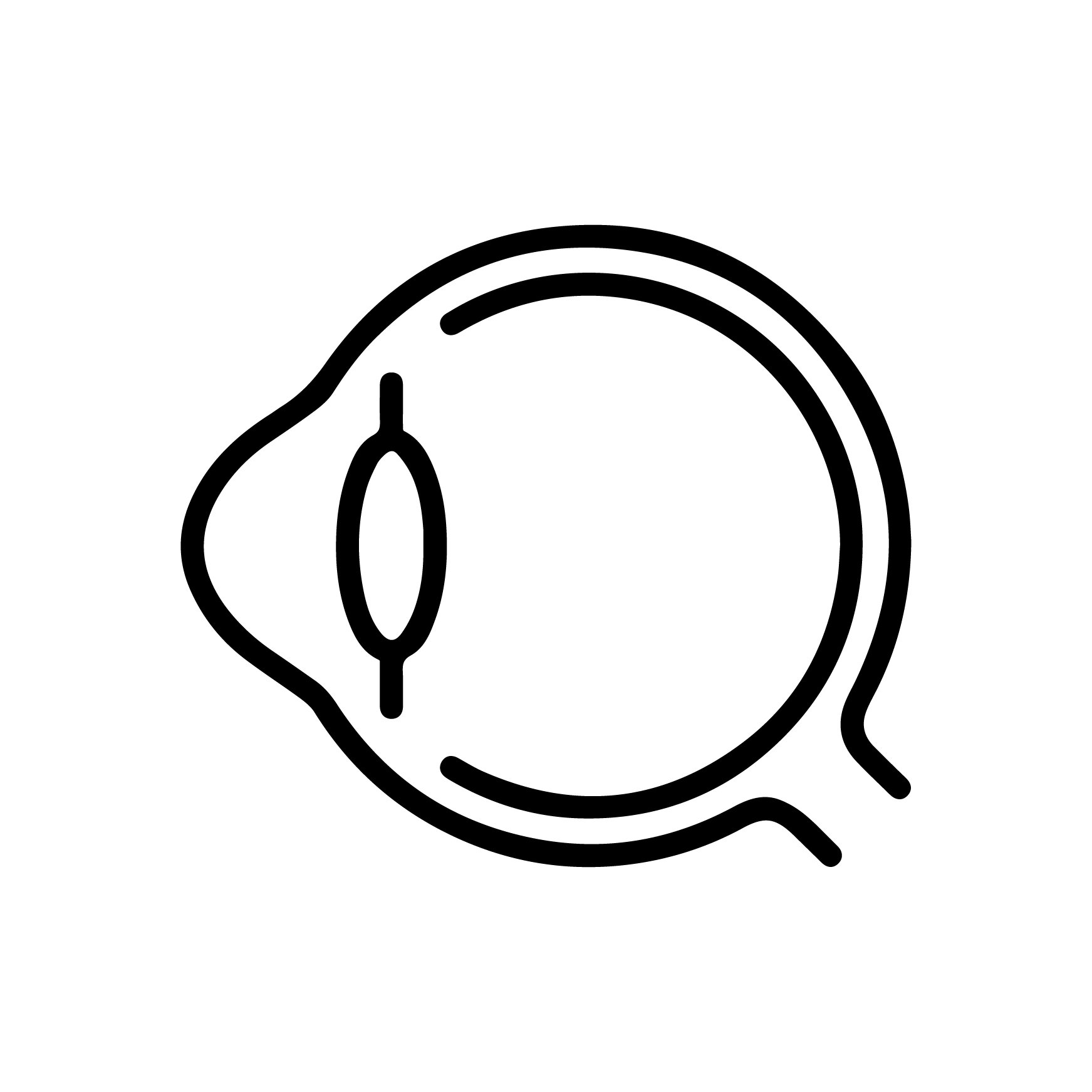 Keratoconus