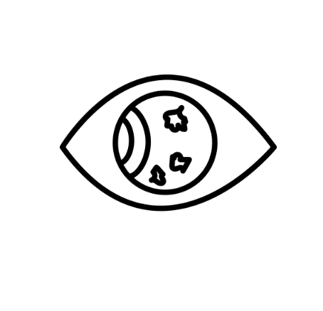 Diabetic Retinopathy